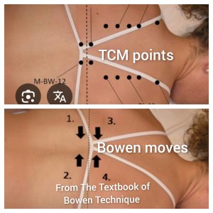 Pain and Wellness Solutions - Bowen and Traditional Chinese Medicine Diagram Showing Points on Back