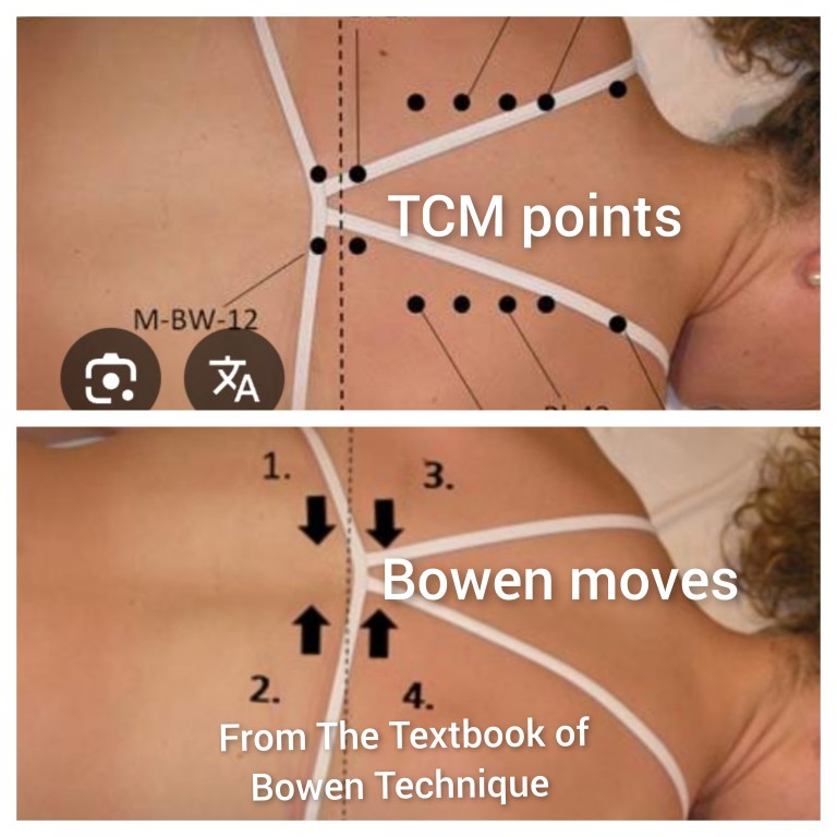 Pain and Wellness Solutions - Bowen and Traditional Chinese Medicine Diagram Showing Points on Back